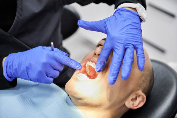 Best Broken or Chipped Tooth Repair in Centereach, NY